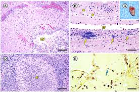 Image result for Erysipeloid
