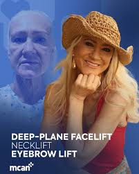 Marina's Rasional Holday: Sayıyorsun hasta 火 olcan MCAN için yapılan  mmaproveamin Mısırulu eğitncu danıştlinysan