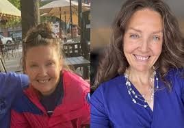 Looking puffy due to hormonal changes? Any tips for reducing puffiness?