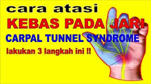 Maybe you would like to learn more about one of these? Cara Mengobati Kebas Pada Jari Tangan Carpal Tunnel Syndrome Dengan 3 Teknik Urutan Youtube