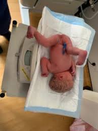 Learn how to turn a breech baby with techniques that work for most pregnancies. Birth Stories Archives Breech Babies Club