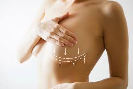 Nipple Enhancement - This Quarterly