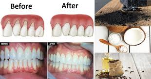 This is an astounding fact! 92 Strong Bones Teeth Ideas Strong Bones Health Teeth