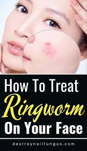 Pin On Remedies It's not caused by worms. pin on remedies