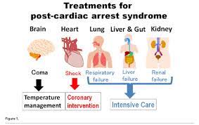 Immediate post cardiac arrest care 1 2 3 4 5 6. Chain Of Survival After Out Of Hospital Cardiac Arrest Healthmanagement Org