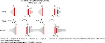 Approach To The Patient With A Heart Murmur Harrisons