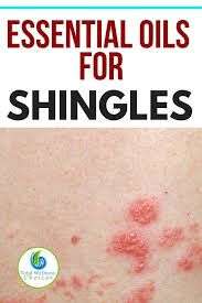 Pin On Essential Oils For Health