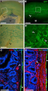 Vessels, adipocytes and an outer layer of mesothelium mesothelium secretes pericardial fluid covers and protects the heart cardiac valves 4 valves 2 av (mitral and tricuspid) in the chambers. Restricted Differentiative Capacity Of Wt1 Expressing Peritoneal Mesothelium In Postnatal And Adult Mice Scientific Reports
