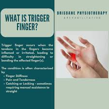 Image result for Trigger Finger