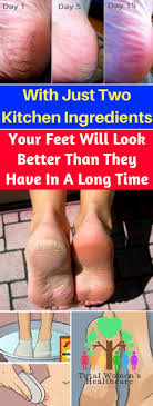 With Just Two Kitchen Ingredients Your Feet Will Look Better Than They Have In A Long Time Women S Healthy News Feet Care Health Healthy Women