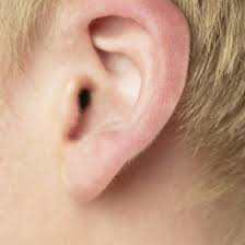 3.2 remove the this helps keep the air pressure behind the eardrum equal. Flying With An Ear Blockage