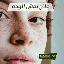 علاج نمش الوجه Movie Posters Movies