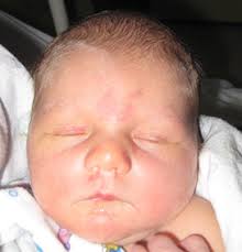 SUMMER 2 0 1 4 LHC Working Toward Baby-Friendly Designation New Hospital  and Clinic Facility Anthocyanins, Anyone?