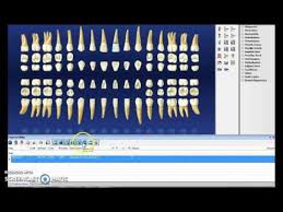 Dentrix Step By Step Charting Youtube