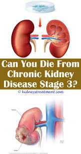 In this article, we discuss the essential information you. Pin On Kidney Disease