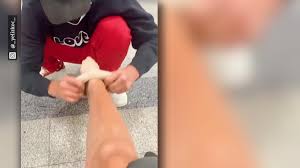 Arzt für behandlung von thrombose in ihrer nähe ausgewählte spezialisten bei leading medicine guide hohe qualifikation jetzt kostenlos kontaktieren! Es Klappt Einfach Nicht Jimi Blue Kampft Mit Thrombose Strumpfen Video Vip De