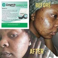 Longrich bamboo charcoal soap side effects. 41 My Longrich Products Catalogue Ideas Network Marketing Quotes Bamboo Charcoal Soap Network Marketing Business