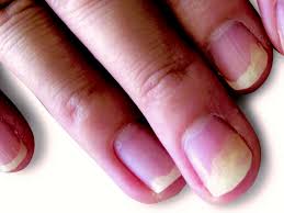 NAIL CLINIQUE