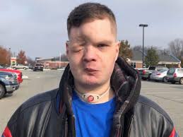 Fundraiser by Libby Livingston : Help James Continue to Heal