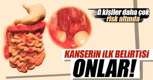 Bagirsakta Polip Olusumuna Etki Eden En Onemli 8 Faktor Saglik Haberleri