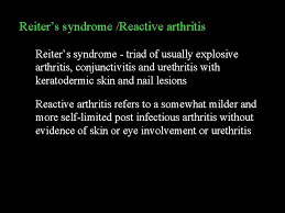 Maybe you would like to learn more about one of these? Class I Associated Autoimmune Diseases A Group Of