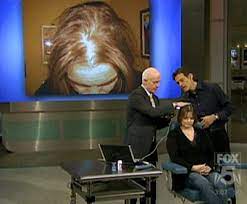 Dr laura berman chemotherapy hair loss & cancer life changes dr oz: Video Dr Oz Show Hair Loss In Women Taboo