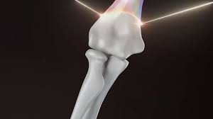 Украинский стартап представил проект по печати человеческих костей ...