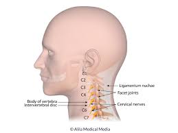 Facet joints are a clinically important source of chronic cervical, thoracic, and lumbar spine pain. Neck Pain Interventus