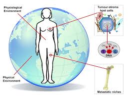 Going through an experience like cancer can make relationships stronger. Critical Research Gaps And Translational Priorities For The Successful Prevention And Treatment Of Breast Cancer Breast Cancer Research Full Text