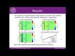 Pulse Wave Velocity Pwv Measurement In Healthy And Diseased Carotid Arteries In Vivo Youtube
