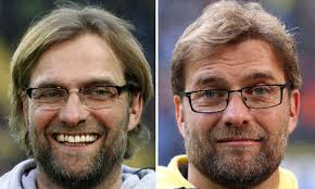 'so i was not surprised when virgil won the uefa. Klopp S Hair Transplant Sparks Aesthetic Debate The Local
