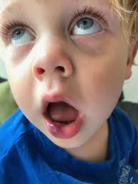 Toddler's tonsillitis left him 'violent and possessed' after triggering  rare illness