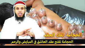 الحجامة تفتح عقد العاشق في المبايض والرحم جواب على سؤال أحد المتابعات Youtube
