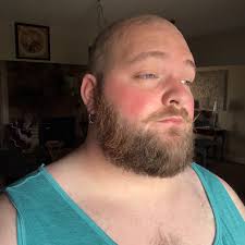 The inventor of the flat free tire deserves a kiss