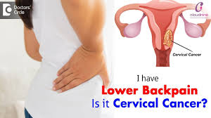 Typically, this is because ovarian cancer symptoms either aren't noticeable in the early stages of the disease or they mimic common stomach and digestive issues that are often women are more likely to experience symptoms once the disease has spread beyond the ovaries, typically to the lymph nodes. Warning Signs Of Cervical Cancer Is Lower Backpain A Sign Of Cervical Cancer Dr Sapna Lulla Youtube