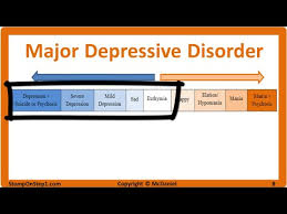 Mood Disorders Major Depressive Disorder Bipolar Type 1