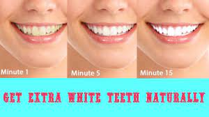 When done the right way, teeth whitening is not bad for your health. Make Your Teeth Crystal White Teeth With These 3 Natural Ways Sudbury Dental