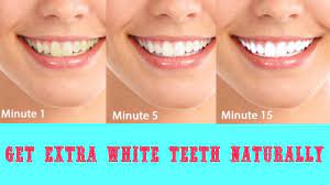 When done the right way, teeth whitening is not bad for your health. Make Your Teeth Crystal White Teeth With These 3 Natural Ways Sudbury Dental