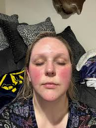 New tattoo with no red skin reaction