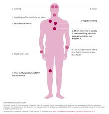 Signs And Symptoms Of Pulmonary Embolism