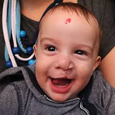 4 Pediatric Problems That Impact Speech Development