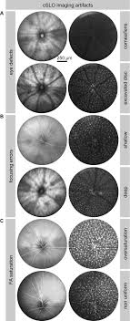 Advanced and the certificate in advanced english (cae), is an english language examination provided by cambridge assessment english (previously known as cambridge english language assessment and university of cambridge esol. In Vivo Dynamics Of Retinal Microglial Activation During Neurodegeneration Confocal Ophthalmoscopic Imaging And Cell Morphometry In Mouse Glaucoma Protocol Translated To German