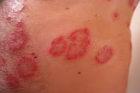 Mj skin and laser clinic (shah alam), klinik mediviron seksyen 22, shah alam, klinik mesra, klinik pakar kulit ranjit, klinik duniamedik. Klinik Kulit Shah Alam Klinik Dr Bazilah Tawarkan Rawatan Kulit