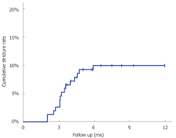 Incidence Of Anastomotic Stricture After Ivor Lewis