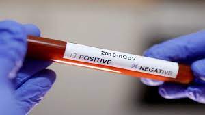 Letztlich ist aber ein falsch positiver test nicht so problematisch: Coronavirus Noida Latest News Coronavirus Outbreak 6 Samples From Noida Test Negative The Economic Times Video Et Now