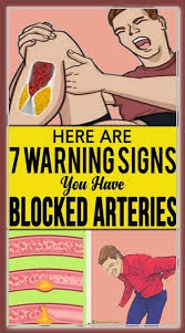 It may come with some blood. Here Are 7 Warning Signs You Have Blocked Arteries Bad Circulation Warning Signs Arteries