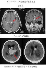 コロナきよつけや みせろー 開脚ー すご おい床そこ代われ 絶対コイツナルシストww 白パンだな 太ももの太さ推定45cm 床になったら直接、パンツをつけ. è„³ç¥žçµŒå¤–ç§'ã®ç—…æ°— è»¢ç§»æ€§è„³è…«ç˜ ç—…æ°—ã®æ²»ç™‚ å¾³æ´²ä¼šã‚°ãƒ«ãƒ¼ãƒ—