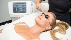 Venus Versa Laser Hair Removal