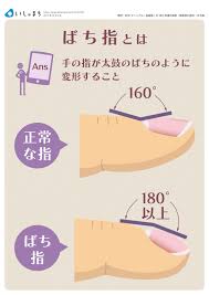 ばち指とは infographics 看護ノート 体重 記録 医療