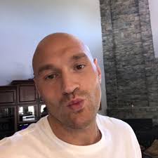 This is a big kiss to Deontay Wilder AKA THE BIG jealous DOSSER, #BUMCITY  #imthekingoftheworld